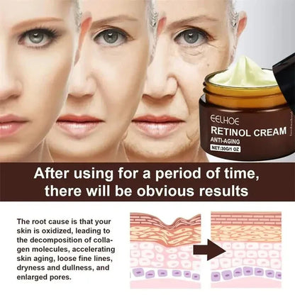 Crème anti-âge  🌬️✨        !🔥 50% Reduction 🔥